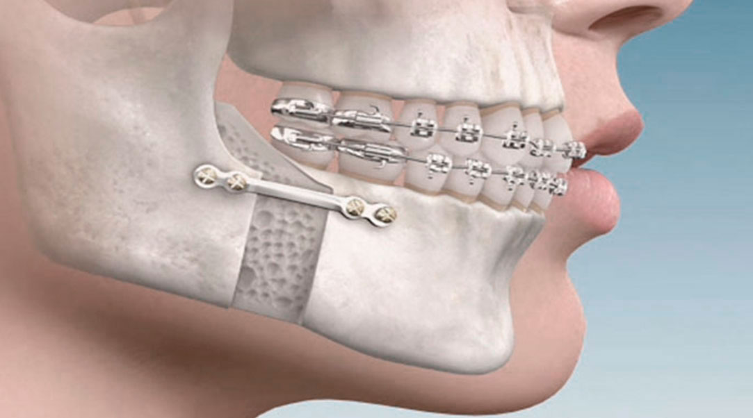 cirurgia-buco-maxilo-facial-03A